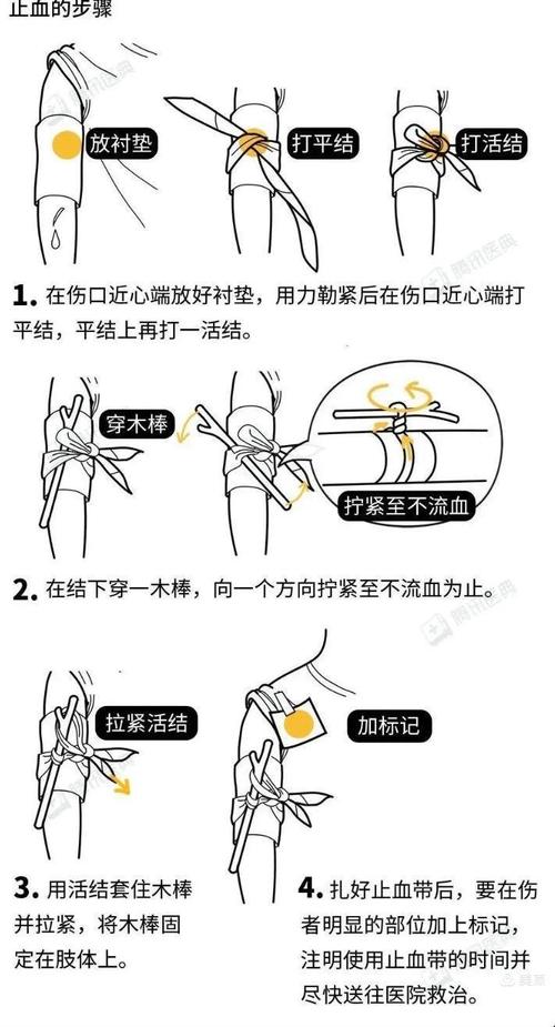 动脉出血怎么止血？教你急救止血的正确方法